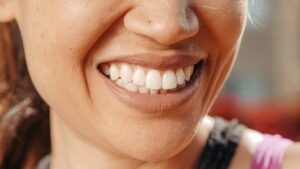 fuquay-varina dentist