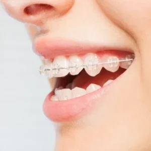cosmetic dentistry fuquay varina
