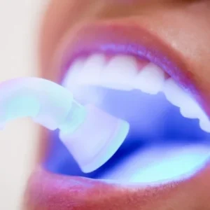 emergency dentistry fuquay varina