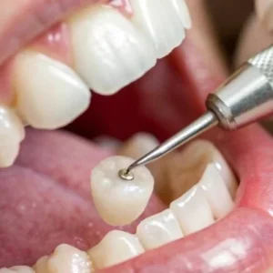 restorative dental treatments fuquay varina
