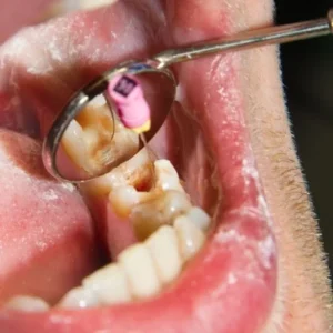 restorative dentistry fuquay-varina