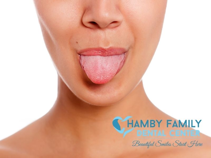 Types of Tongue Diseases and how to treat them
